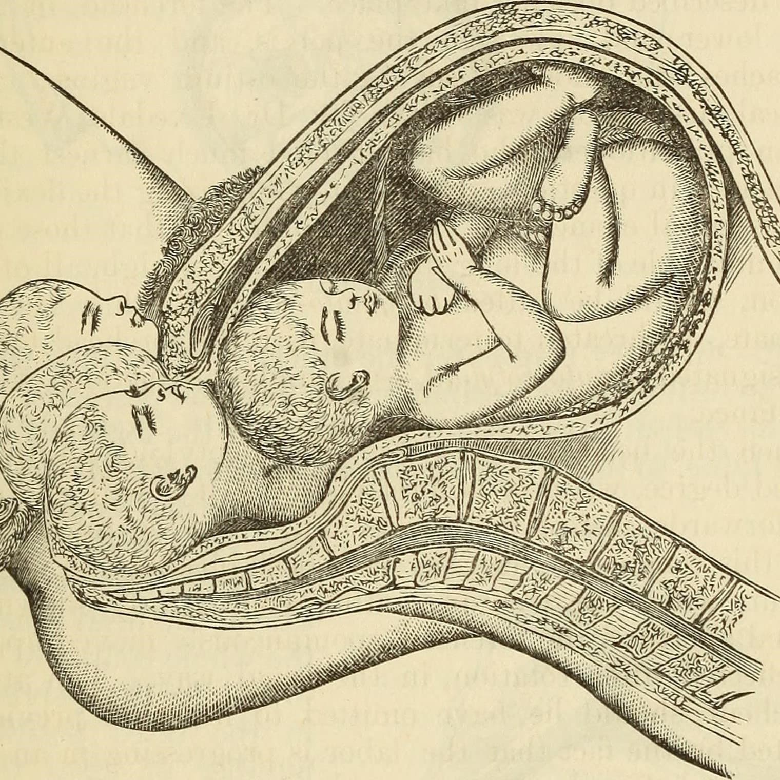 A system of midwifery, including the diseases of pregnancy and the puerperal state